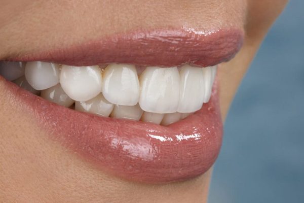 CARILLAS-DENTALES